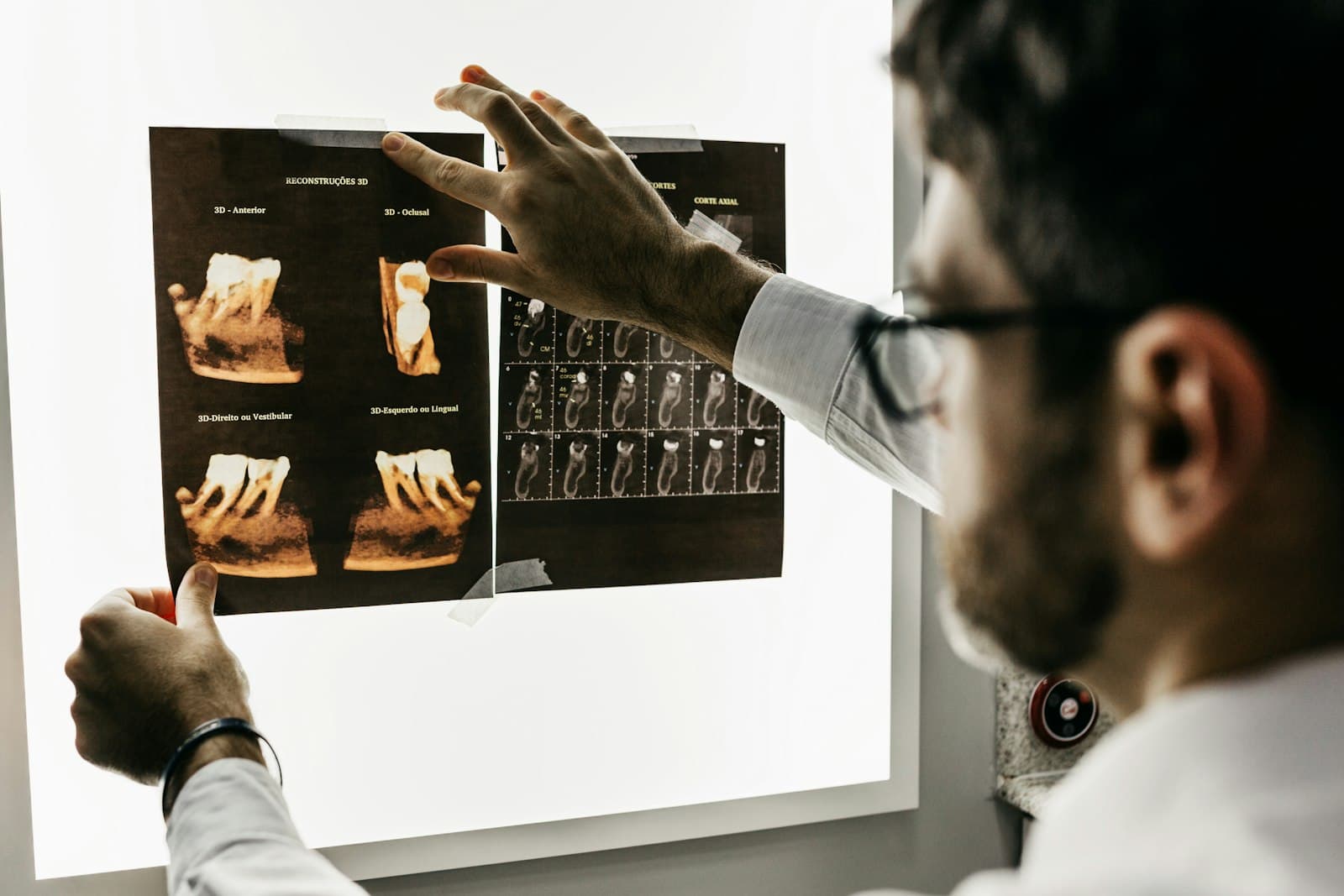 Dentist reviewing x-rays with a patient